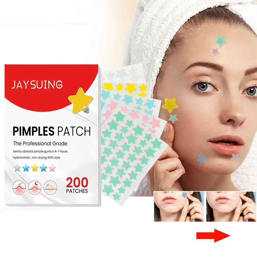 200pcs Star Pimple Patch Acne Colorful Invisible Acne